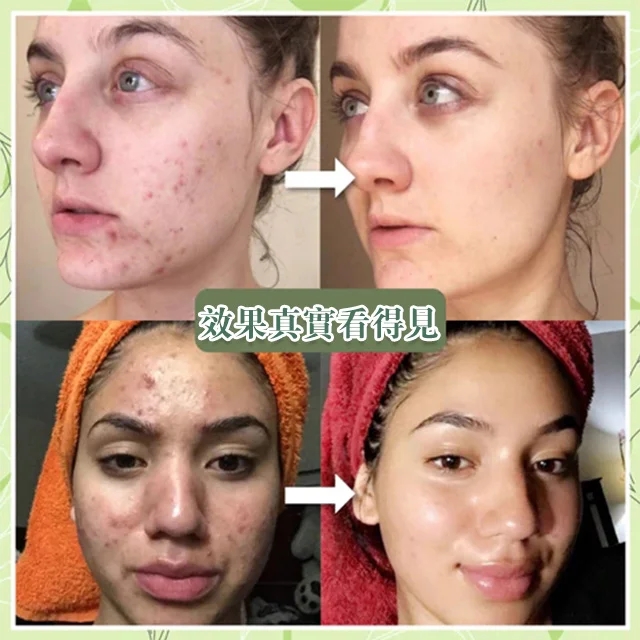 綠茶保濕清潔泥膜,告別油膩臟臟臉,挑戰去污後不拔幹 綠茶保濕清潔泥膜,告別油膩臟臟臉,挑戰去污後不拔幹