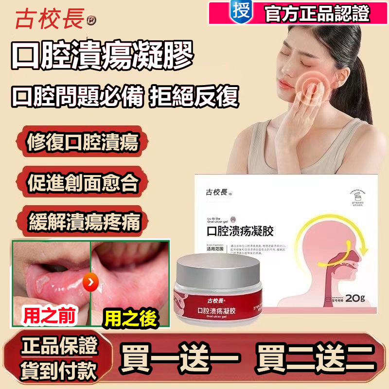 【正品保障】古校長口腔潰瘍凝膠 口腔問題專用！徹底斷根不反复！