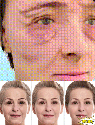 美白祛斑淡斑霜